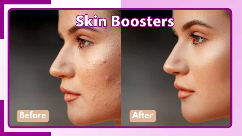 Skin Boosters in Kathmandu Nepal – Deep Hydration & Radiant Skin