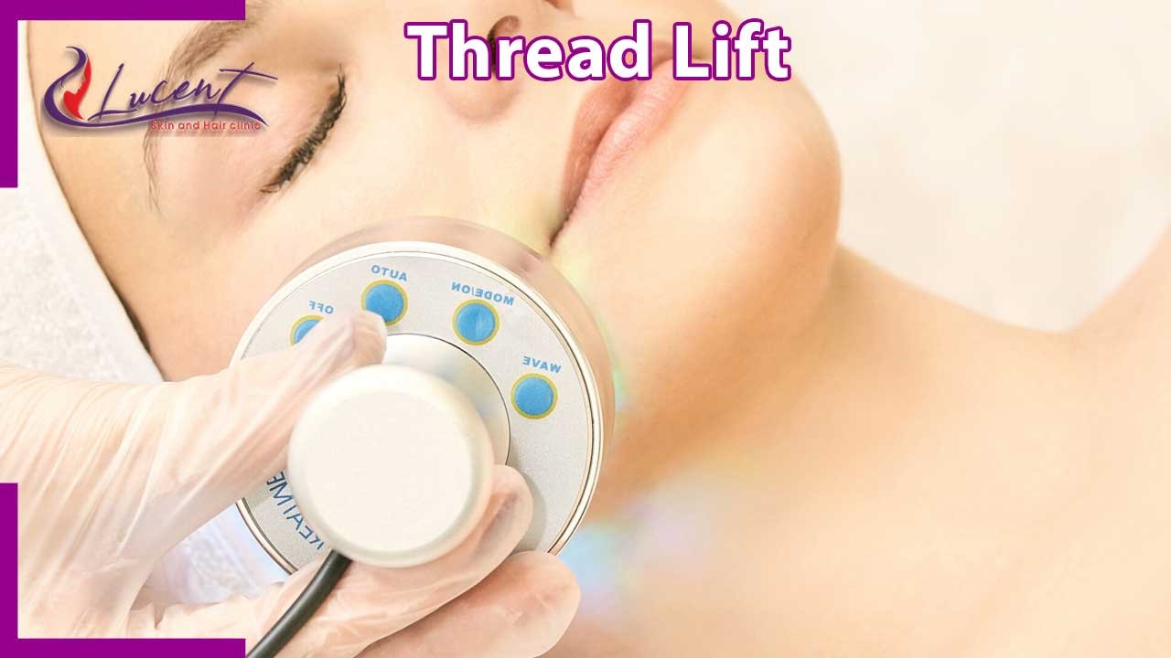 Thread Lift at Lucent Skin and Hair Clinic