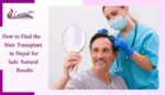 Best Hair Transplant in Nepal at Lucent Skin and Hair Clinic