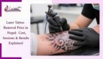 Laser tattoo removal price in Nepal