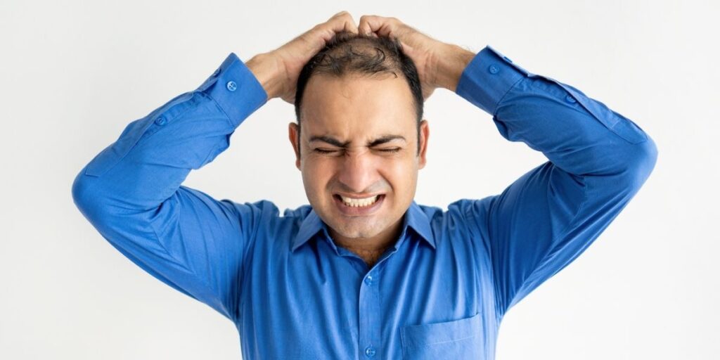 First signs of hair loss is affecting man's confidence