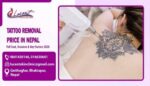 Tattoo removal price in nepal