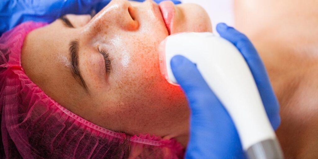 woman getting the treatment of hyperpigmentation
